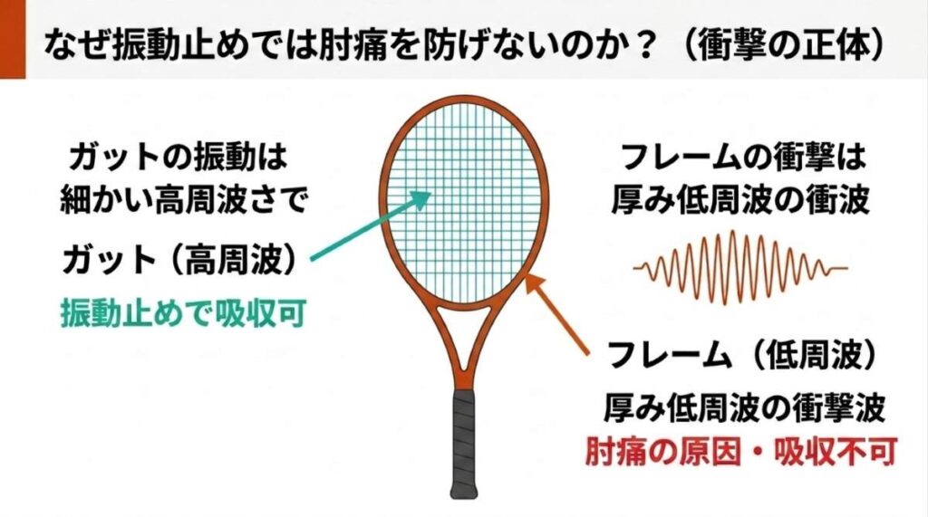 テニスラケットにおけるガットの高周波振動（振動止めで吸収可能）とフレームの低周波衝撃（肘痛の原因）の違いを比較した図解